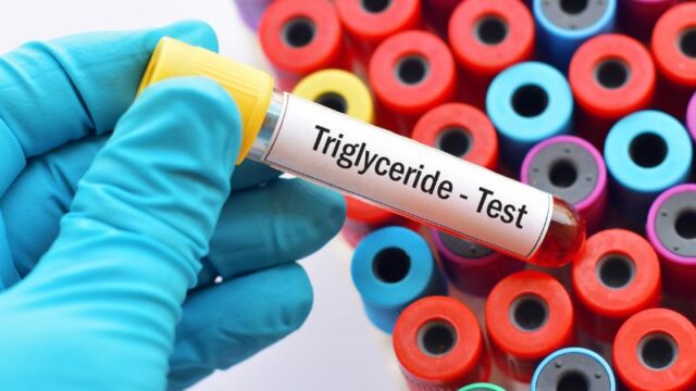 Cekricek.id - Kurangnya pengetahuan terkadang membuat seseorang sulit untuk membedakan antara trigliserida dengan kolestero