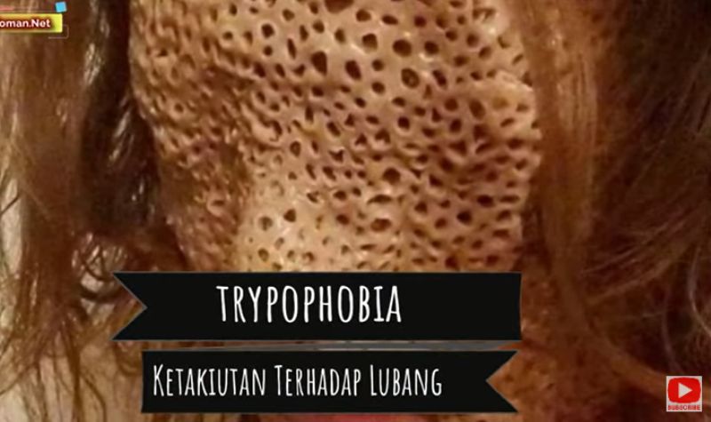 Cekricek.id, Kesehatan -  5 Penyakit Langka dan Paling Aneh yang Ada di Dunia
