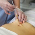 Cekricek.id, Kecantikan - Istilah suntik putih serta infus whitening umum digunakan oleh sejumlah orang yang ingin mendapatkan kulit putih instan.
