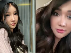 Lucinta Luna membagikan video dirinya yang memperlihatkan perbedaan drastis pada wajahnya usai beberapa kali operasi ke luar negeri.