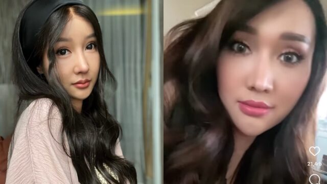 Lucinta Luna membagikan video dirinya yang memperlihatkan perbedaan drastis pada wajahnya usai beberapa kali operasi ke luar negeri.