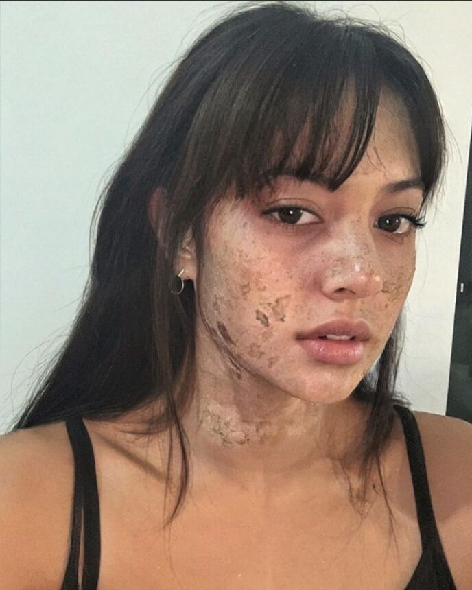 Cekricek.id, Berita Seleb dan Berita Artis - Penampilan Baru Aurelie Moeremans Bikin Geger, Wajah Gosong Mengelupas Dikira Penyakit