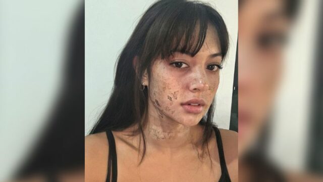 Cekricek.id, Berita Artis dan Berita Seleb - Artis serta pemeran cantik Aurelie Moeremans membagikan potretnya dengan wajah yang terlihat aneh.