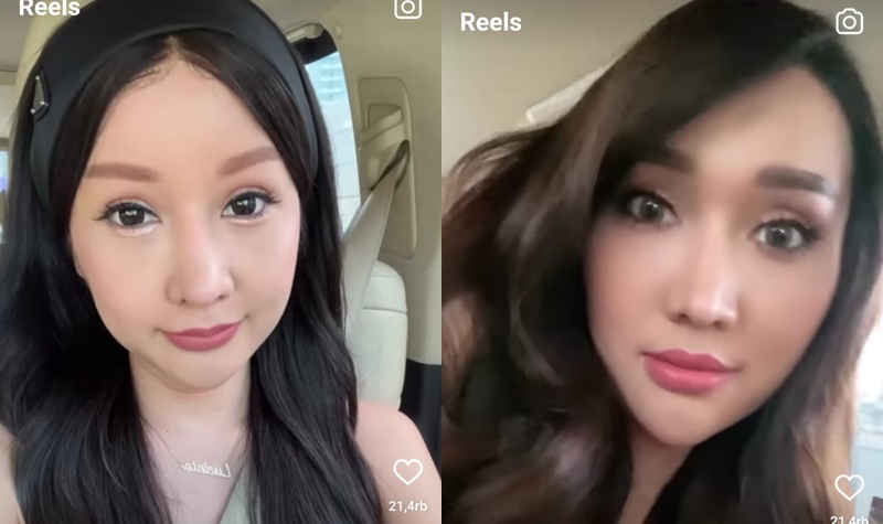 Cekricek.id, Berita Artis dan Berita Selebriti - Lucinta Luna bagikan video perbedaan drastis wajahnya usai beberapa kali operasi ke luar negeri.