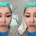 Cekricek.id, Berita Seleb dan Berita Artis – Lucinta Luna semakin gencar mempermak wajahnya agar terlihat seperti idol Kpop favoritnya. Sebelumnya, dia melakukan operasi plastik agar penampakan wajahnya mirip wanita Korea Selatan. Dia menjadikan wajah Lisa dan Jisoo Blackpink sebagai inspirasinya.