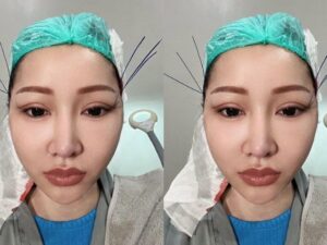 Cekricek.id, Berita Seleb dan Berita Artis – Lucinta Luna semakin gencar mempermak wajahnya agar terlihat seperti idol Kpop favoritnya. Sebelumnya, dia melakukan operasi plastik agar penampakan wajahnya mirip wanita Korea Selatan. Dia menjadikan wajah Lisa dan Jisoo Blackpink sebagai inspirasinya.
