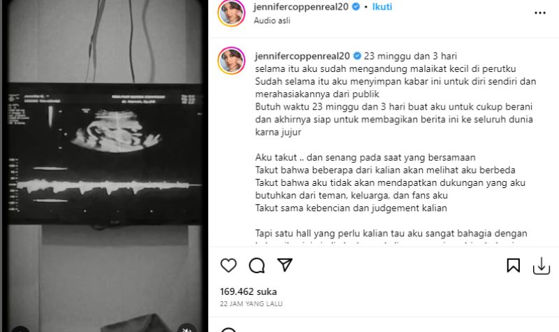 Cekricek.id, Berita Artis dan Berita Seleb - Artis cantik Jennifer Coppen kini membagikan sebuah kabar yang cukup mengejutkan tentang kehamilan