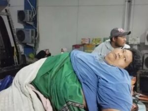 Ini Penyebab Fajri Pria 300Kg Meninggal Dunia