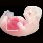 Ilmuwan Tiongkok Berhasil Kembangkan Ginjal Manusia dalam Embrio Babi