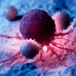 Diabetes Berdampak pada Pertumbuhan Sel Kanker?