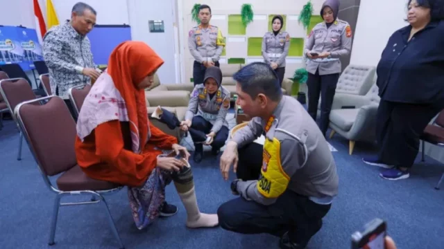 Yubita Hida Aprilia, mahasiswi UGM, menerima kaki palsu baru dari Kombespol Alfian. Kisah inspiratif tentang semangat, harapan, dan pendidikan inklusif.