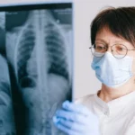 Cekricek.id - Temuan Sel 'Ikan' di Paru-Paru Manusia, Mengungkap Penyebab Cystic Fibrosis