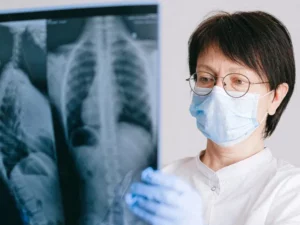 Cekricek.id - Temuan Sel 'Ikan' di Paru-Paru Manusia, Mengungkap Penyebab Cystic Fibrosis