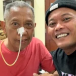 Kondisi Terbaru Tukul Arwana, Foto Bersama Sule Tampak Menggunakan Selang di Hidung