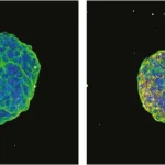 Perbandingan sferoid tumor pankreas kontrol dan yang diberi terapi antisense oligonukleotida