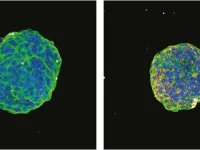 Perbandingan sferoid tumor pankreas kontrol dan yang diberi terapi antisense oligonukleotida