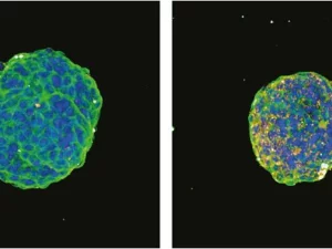 Perbandingan sferoid tumor pankreas kontrol dan yang diberi terapi antisense oligonukleotida