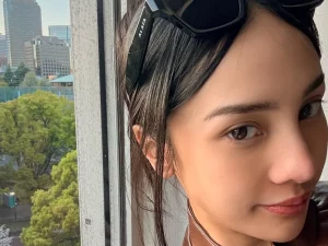Anya Geraldine berswafoto dengan latar gedung dan pepohonan di Jepang