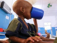 Seorang anak Somalia yang menderita gizi buruk minum di fasilitas kesehatan