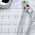 Ilustrasi rekaman elektrokardiogram (EKG)