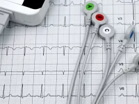 Ilustrasi rekaman elektrokardiogram (EKG)