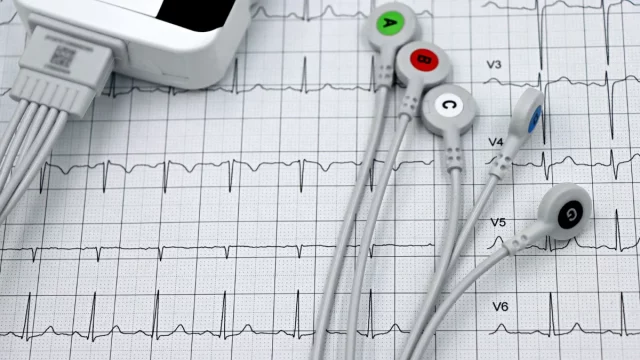 Ilustrasi rekaman elektrokardiogram (EKG)