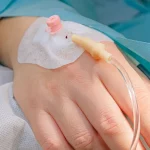 Tangan pasien yang tengah menjalani terapi intravena