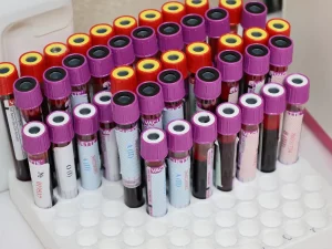 Panel Tujuh Protein Darah Diklaim Lebih Akurat Deteksi Tahap Lanjut Alzheimer