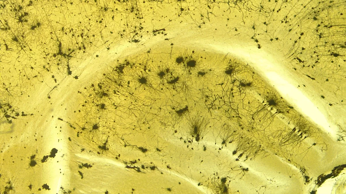 Dua Metode Hitung Amiloid-Beta Memberi Hasil yang Sama 2 Irisan jaringan hipokampus dengan pewarnaan yang memperlihatkan sel saraf berwarna gelap