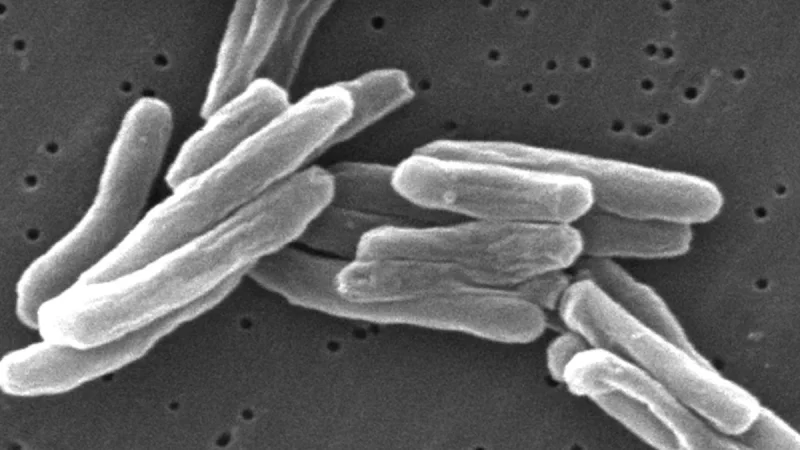 Bakteri Mycobacterium tuberculosis berbentuk batang di bawah mikroskop elektron