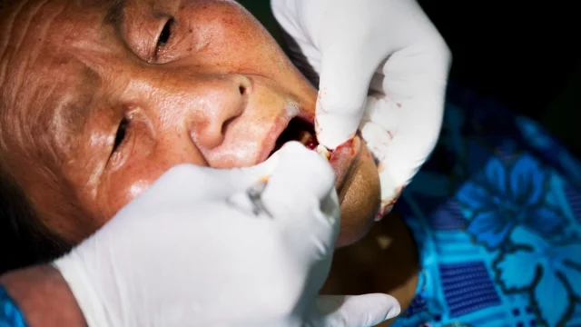 Dokter gigi mencabut gigi perempuan lansia dalam layanan gigi gratis di Ulaanbaatar, Mongolia