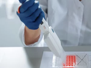 Tangan peneliti bersarung tangan menggunakan pipet di atas wadah sampel di laboratorium