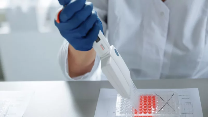 Tangan peneliti bersarung tangan menggunakan pipet di atas wadah sampel di laboratorium