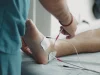 Ilustrasi tenaga kesehatan memasang elektrode di telapak kaki pasien yang terbaring