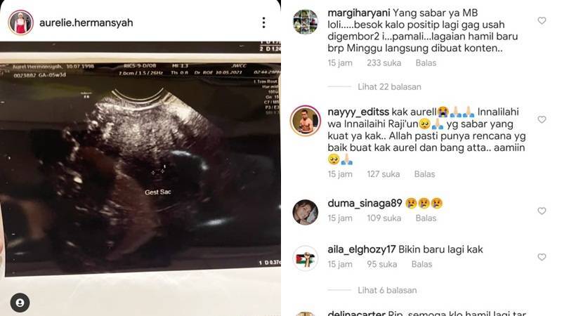 Aurel Hermansyah Keguguran, Netizen Ingatkan Tak Usah Diumbar-umbar Lagi 2 Lampiran Gambar