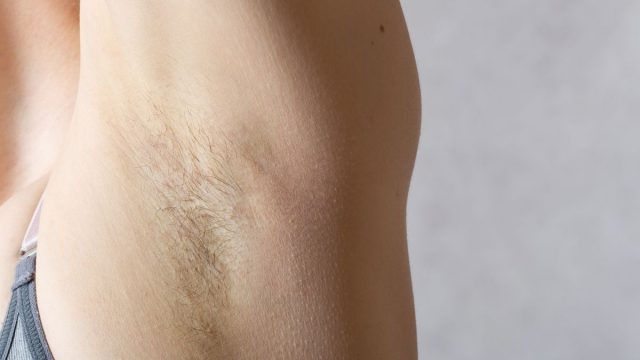 Ini lah cara merontokkan bulu ketiak dengan bahan-bahan alami. Kamu bisa menggunakan lidah buaya, Tepung Maizena, dan temu kunyit.