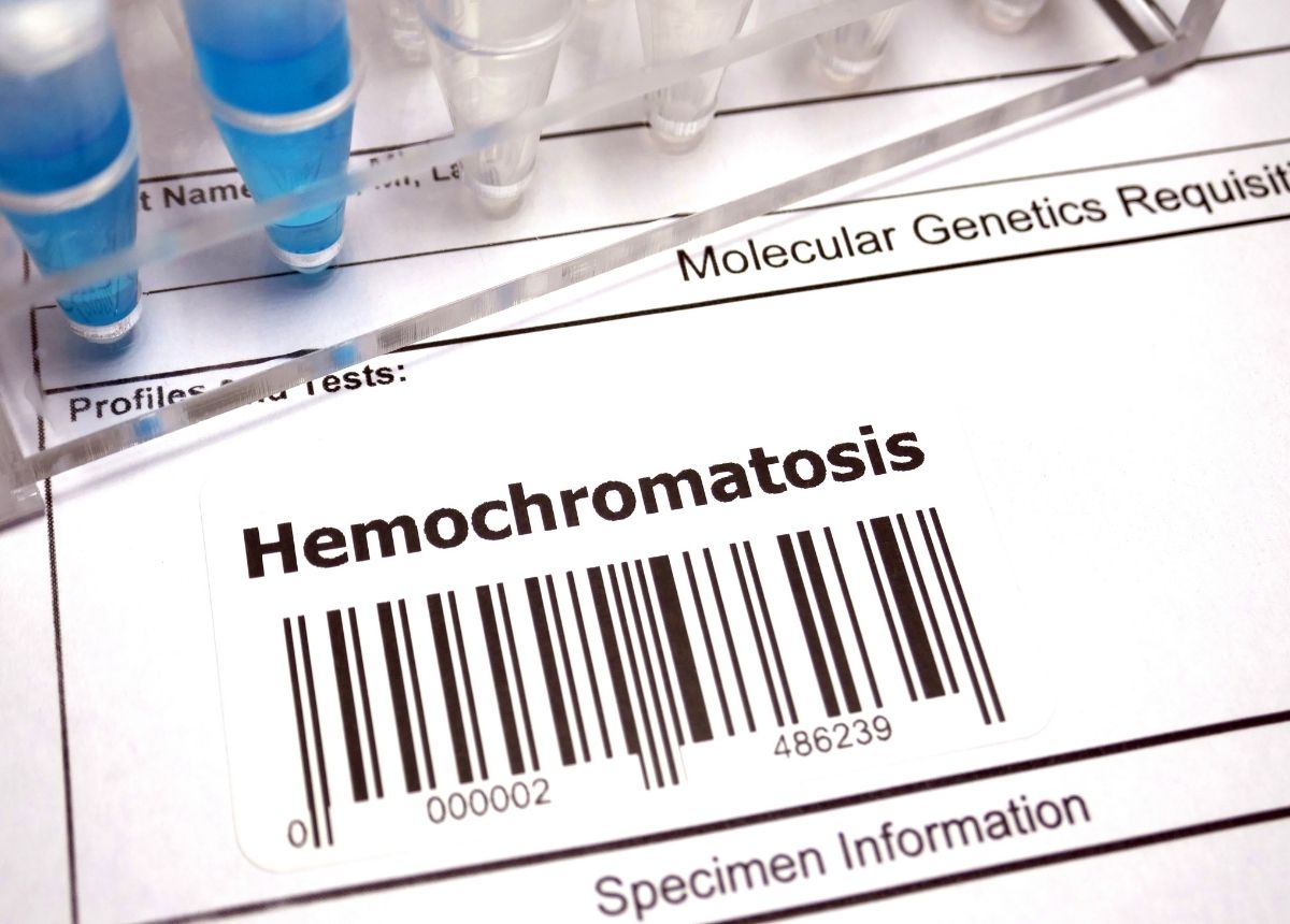 Hemokromatosis