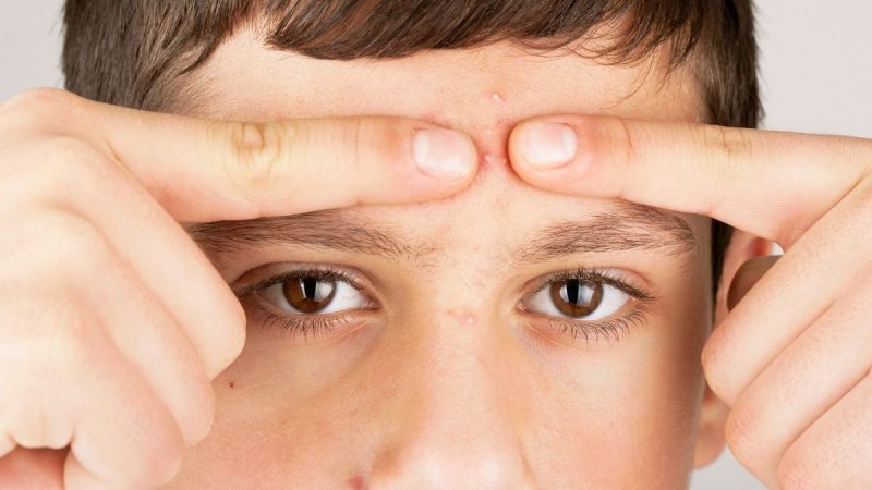 Berita terbaru hari ini: whitehead