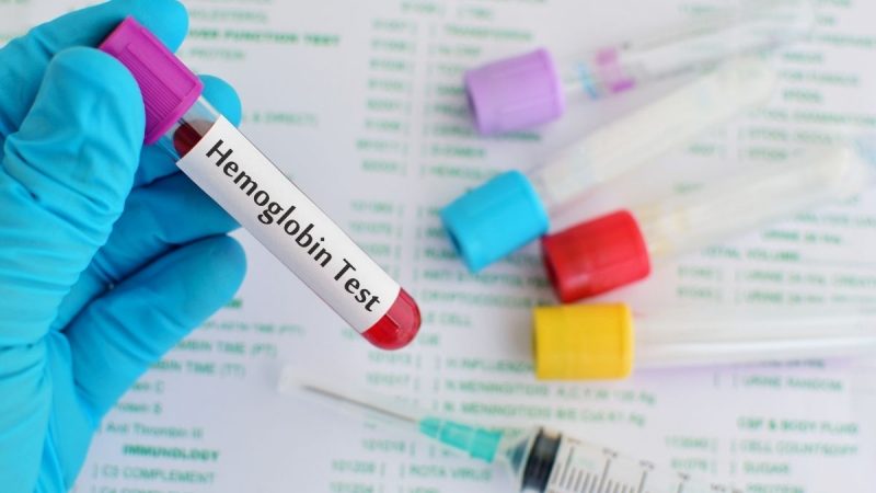 Bahaya Hemoglobin (HB) Rendah, Ini yang Akan Terjadi pada Tubuh Seperti Kelelahan Berlebihan