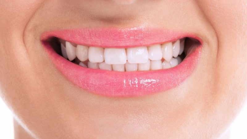 Berita terbaru hari ini: Cara memutihkan gigi secara alami