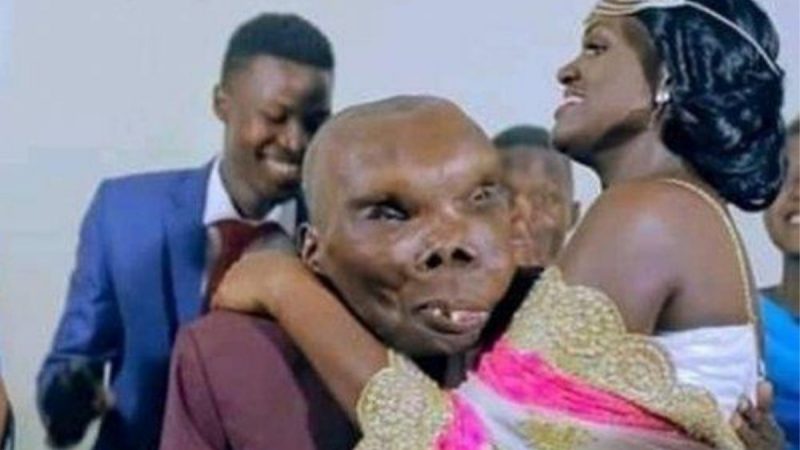 Meski Dijuluki Pemilik Wajah Paling Jelek di Dunia, Godfrey Baguma Bisa Dapatkan Istri Cantik Loh