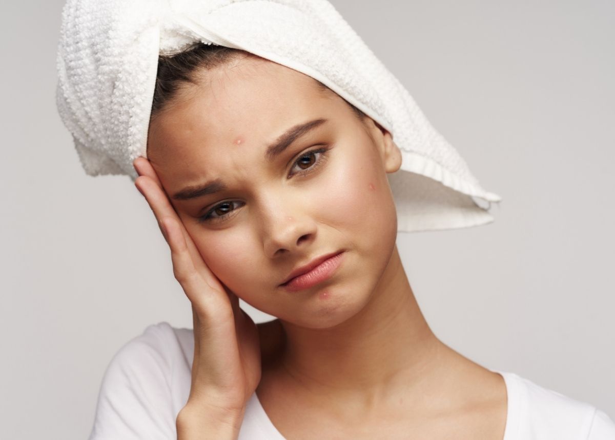 Anda bisa mencegah kulit terutama muka tidak berjerawat. Paling mudah, anda bisa menghindari jenis makanan yang mengandung beberapa bahan ini