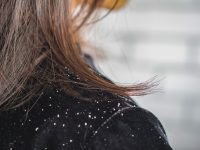 Berita gaya hidup, kesehatan, dan tips terbaru hari ini: 4 cara ini bisa anda lakukan untuk hilangkan ketombe. Anda bisa rajin keramas, menggunakan tea tree oil, kurangi konsumsi gula dan mencoba cuka apel.