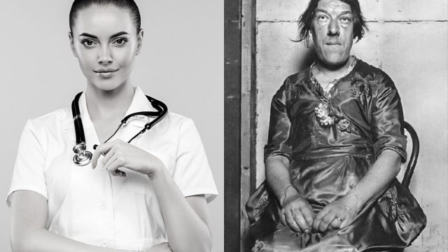 Berita terbaru, terkini dan berita pilihan hari ini: Waktu muda Mary Ann Bevan adalah seorang perawat yang sangat cantik, tapi kemudian sesuatu yang malang menimpanya yang membuat ia dijuluki wanita terjelek.