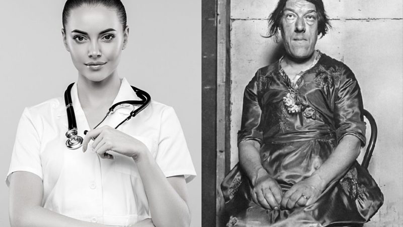 Berita terbaru, terkini dan berita pilihan hari ini: Waktu muda Mary Ann Bevan adalah seorang perawat yang sangat cantik, tapi kemudian sesuatu yang malang menimpanya yang membuat ia dijuluki wanita terjelek.