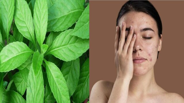 Berita gaya hidup: Siapa sangka, ternyata untuk menghilangkan bekas jerawat tak harus mengeluarkan biaya mahal, cukup dengan mengaplikasikan daun ini.