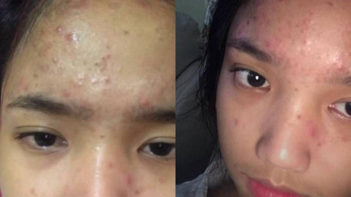 Intip Foto Jadul Fuji, Lucu Banget 7 Lampiran Gambar