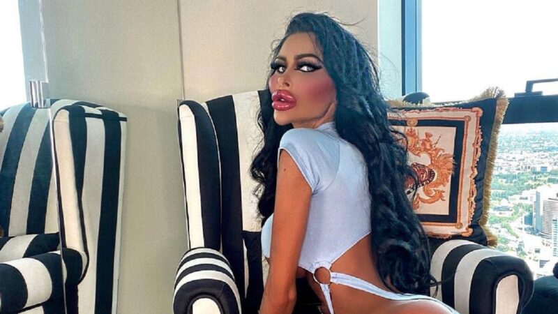 Berita terbaru: Wanita ini habis uang hingga Rp2 miliar untuk oplas, namun wajahnya bukan makin cantik malah semakin mengerikan