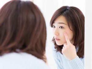 Cara mengatasi jerawat