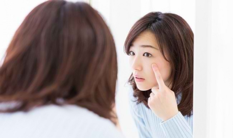 Cara mengatasi jerawat